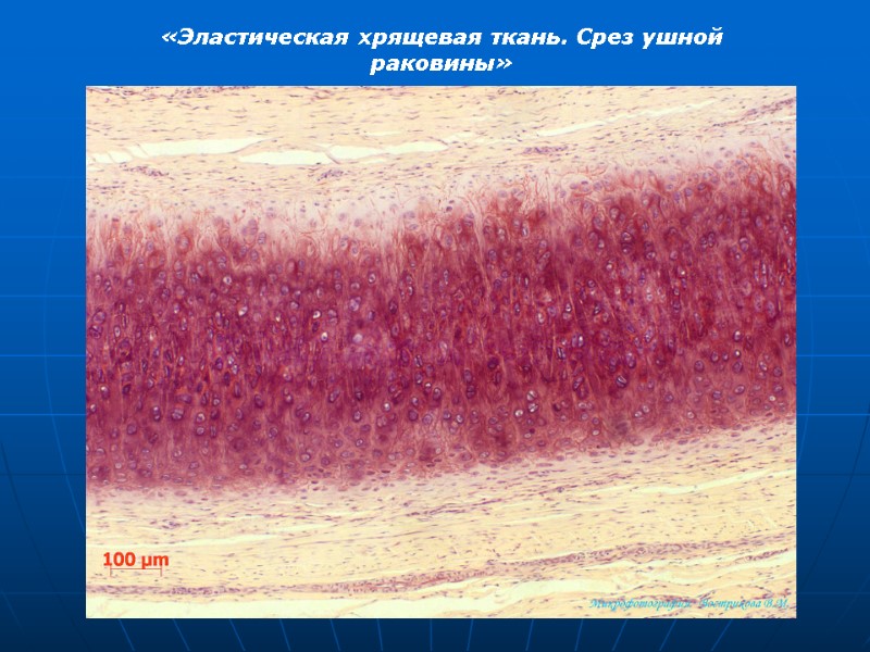 «Эластическая хрящевая ткань. Срез ушной раковины»